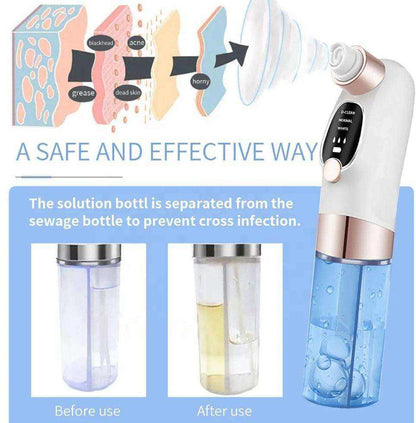 Blackhead Vacuum Remover